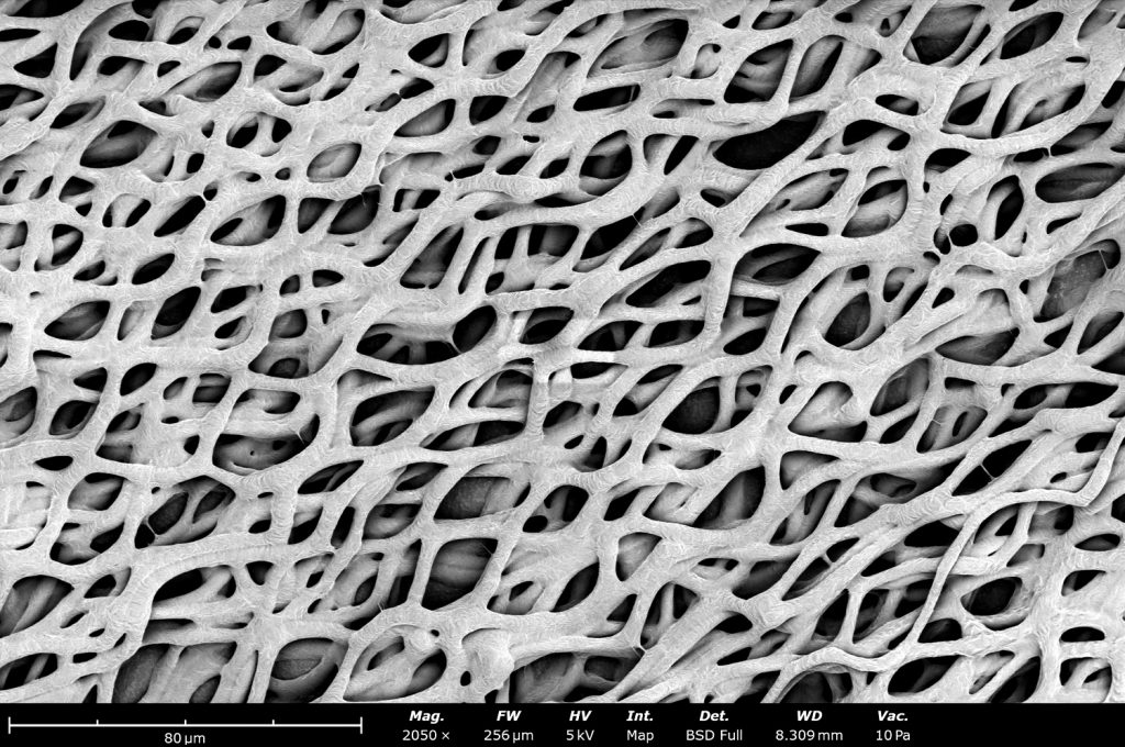 This SEM image shows electrospun polycaprolactone (PCL) made in a Fluidnatek LE-50 at 1,000 rpm and at a translational needle speed of 20 mm/s and a low voltage of -4 kV. The combination of slow translational speed, along with the high rpm and low voltage, allowed the fibers to be collected with a peculiar wavy pattern with significant amount of fiber-fiber bonding that can increase mechanical properties of the final sample.