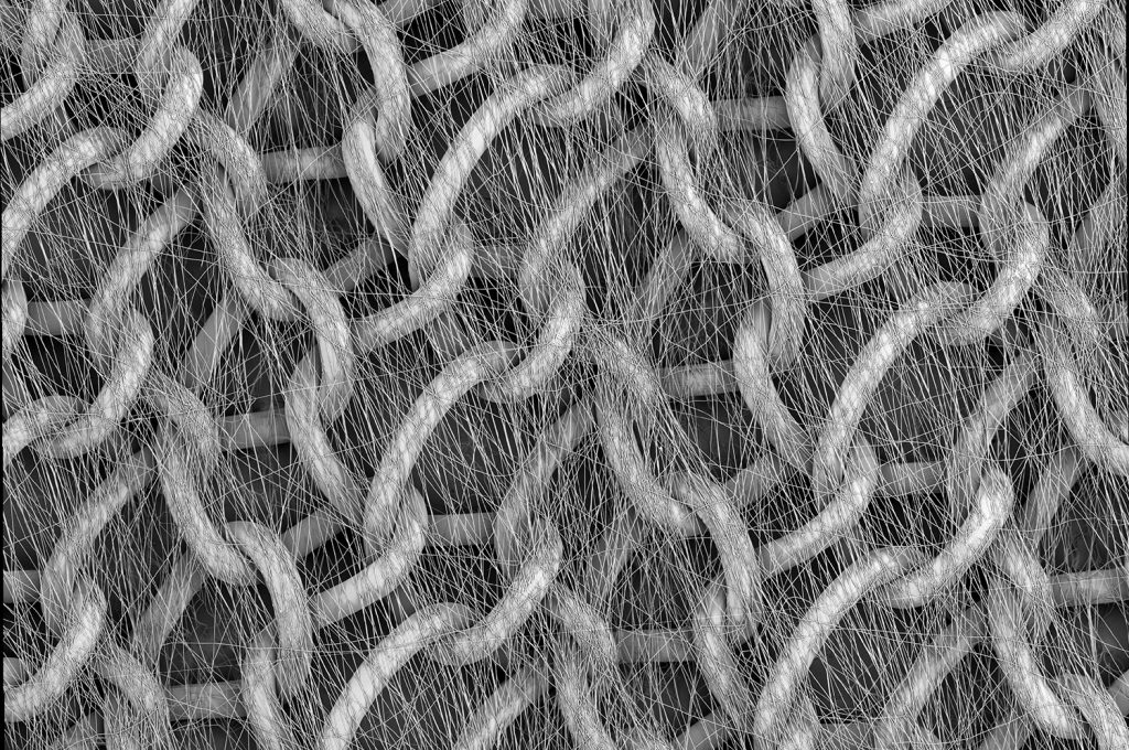 Overall view of a surgical mesh coated with electrospun thermoplastic polyurethane (TPU) fibers. TPU fibers were used to coat the surface of the surgical mesh to make it more biocompatible by allowing the structure to resemble the extracellular matrix. By using electrospinning, the addition of fibers can make the surgical mesh more biocompatible and accepted by the body after implantation.